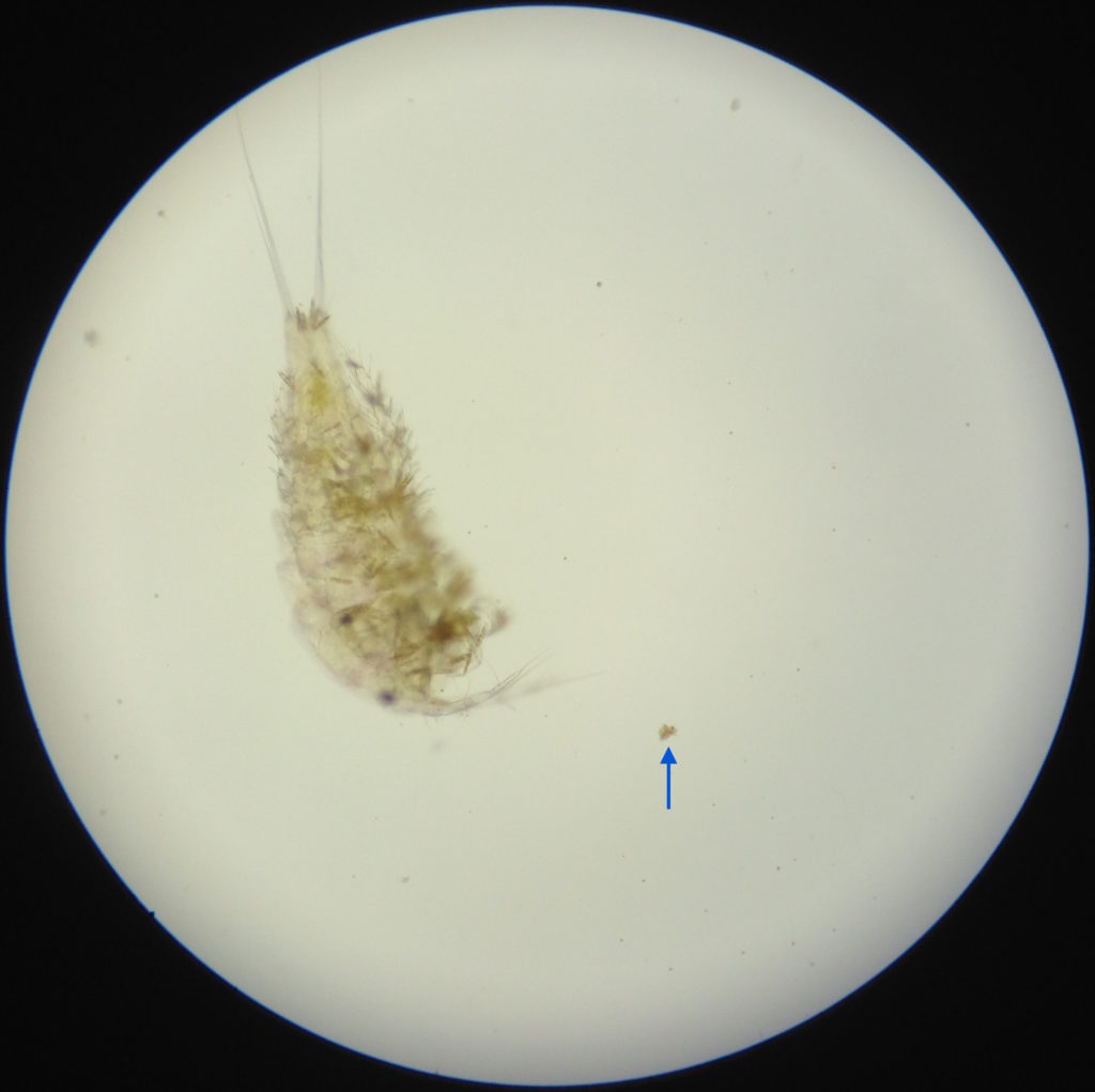 Copepods under microscope