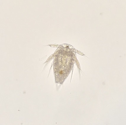 Tig Copepod Nauplius