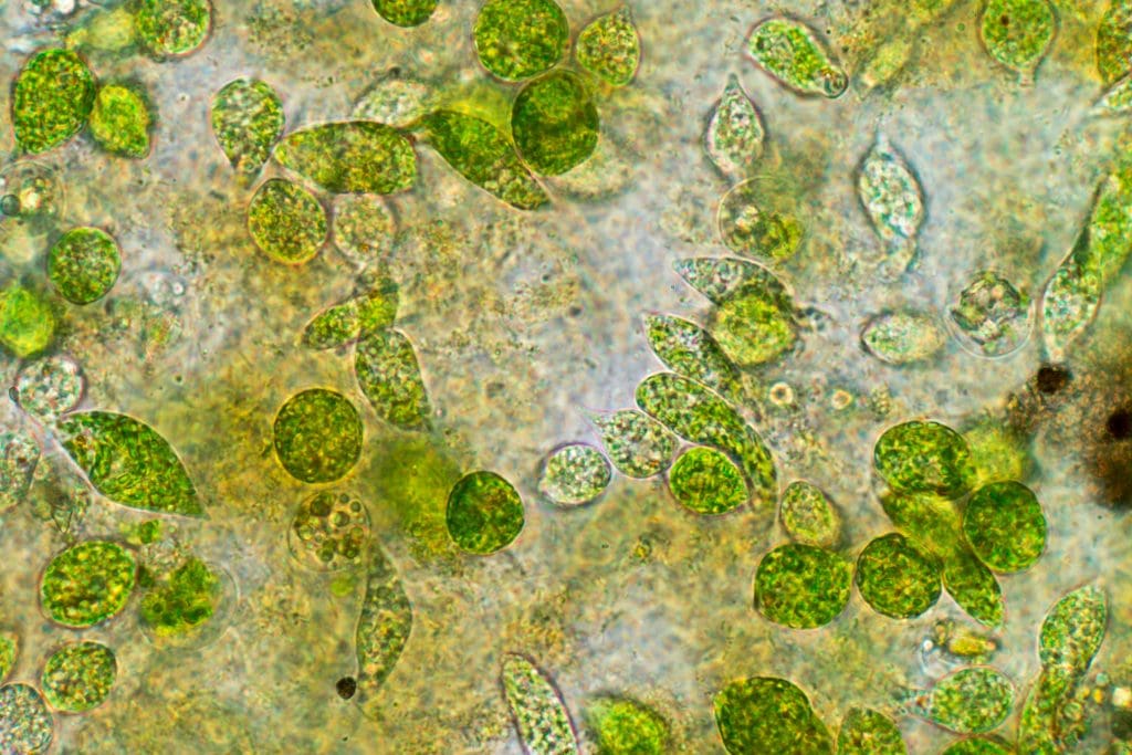 Phytoplankton very magnified