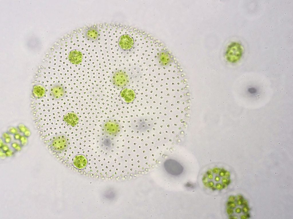 Phytoplankton under microscope